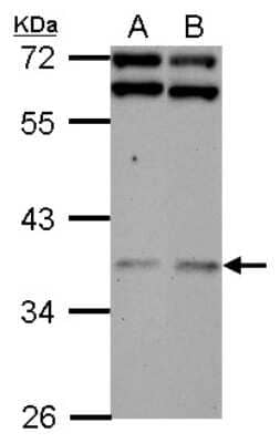 Western Blot: DNAJB7 Antibody [NBP2-16194] - Sample (30 ug of whole cell lysate) A: NT2D1 B: SK-N-SH 10% SDS PAGE gel, diluted at 1:3000.