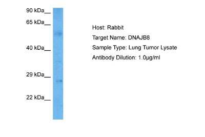 Western Blot: DNAJB8 Antibody [NBP2-84007] - Host: Rabbit. Target Name: DNAJB8. Sample Tissue: Human Lung Tumor lysates. Antibody Dilution: 1ug/ml