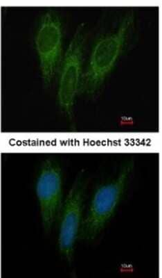 Immunocytochemistry/ Immunofluorescence DNAJC1 Antibody