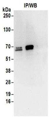 Immunoprecipitation: DNAJC1 Antibody [NBP2-32128] - Samples:  Whole cell lysate (1 mg for IP; 20% of IP loaded) from Jurkat cells.  Antibodies:  Affinity purified rabbit anti-MTJ1 antibody NBP2-32128 used for IP at 6 ug/mg lysate. For blotting immunoprecipitated MTJ1, NBP2-32128 was used at 1 ug/ml.  Detection: Chemiluminescence with an exposure time of 10 seconds.