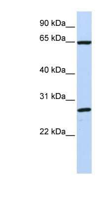 Western Blot: DNAJC1 Antibody [NBP1-62602] - Titration: 0.2-1 ug/ml, Positive Control: MCF7 cell lysate.