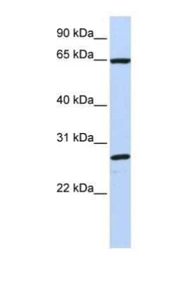 Western Blot: DNAJC1 Antibody [NBP1-69608] - This Anti-DNAJC1 antibody was used in Western Blot of MCF7 tissue lysate at a concentration of 1ug/ml.