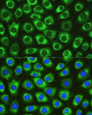 Immunocytochemistry/Immunofluorescence: DNAJC10 Antibody [NBP2-92054] - Immunofluorescence analysis of L929 cells using DNAJC10 Rabbit pAb (NBP2-92054) at dilution of 1:100. Blue: DAPI for nuclear staining.