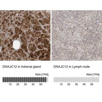 <b>Orthogonal Strategies Validation. </b>Immunohistochemistry-Paraffin: DNAJC12 Antibody [NBP1-83083] - Staining in human adrenal gland and lymph node tissues using anti-DNAJC12 antibody. Corresponding DNAJC12 RNA-seq data are presented for the same tissues.