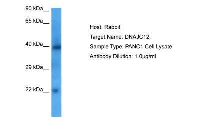 Western Blot: DNAJC12 Antibody [NBP2-84803] - Host: Rabbit. Target Name: DNAJC12. Sample Tissue: PANC1 Whole Cell lysates. Antibody Dilution: 1.0ug/ml