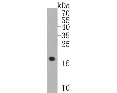 Western Blot: DNAJC15 Antibody (SY26-04) [NBP2-67439] - Western blot analysis of DNAJC15 on mouse heart tissue lysates. Proteins were transferred to a PVDF membrane and blocked with 5% BSA in PBS for 1 hour at room temperature. The primary antibody (1/500) was used in 5% BSA at room temperature for 2 hours. Go