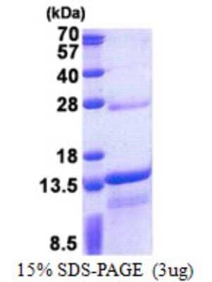 SDS-PAGE Recombinant Human DNAJC15 His Protein