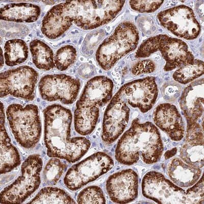 Immunohistochemistry-Paraffin: DNAJC16 Antibody [NBP1-81454] - Staining of human kidney shows strong cytoplasmic positivity in cells in tubules.