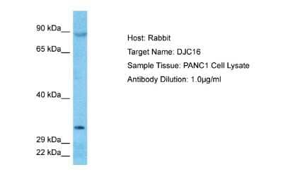 Western Blot: DNAJC16 Antibody [NBP2-82900] - Host: Rabbit. Target Name: DJC16. Sample Type: PANC1 Whole Cell lysates. Antibody Dilution: 1.0ug/ml