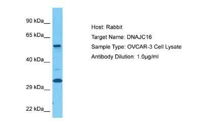 Western Blot DNAJC16 Antibody - BSA Free
