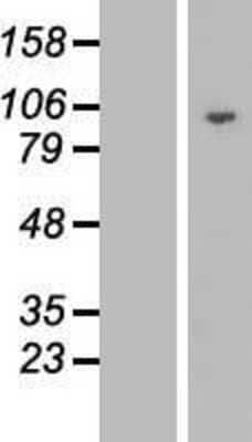 Western Blot DNAJC16 Overexpression Lysate