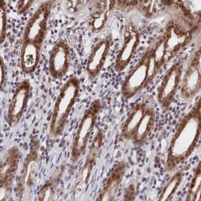 Immunohistochemistry-Paraffin: DNAJC17 Antibody [NBP1-84614] - Staining of human stomach, upper shows moderate cytoplasmic and nuclear positivity in glandular cells.