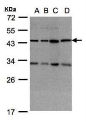 Western Blot: DNAJC17 Antibody [NBP1-32472] - (30 ug whole cell lysate)  A:293T B:A431 C:HeLa S3 D:Raji  12% SDS PAGE diluted at 1:1000