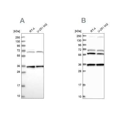 Western Blot: DNAJC17 Antibody [NBP1-84613] - Analysis using Anti-DNAJC17 antibody NBP1-84613 (A) shows similar pattern to independent antibody NBP1-84614 (B).