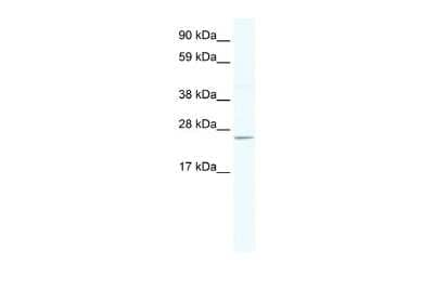 Western Blot: DNAJC17 Antibody [NBP2-87289] - WB Suggested Anti-DNAJC17 Antibody Titration: 2.5ug/ml. ELISA Titer: 1:312500. Positive Control: SP2/0 cell lysate