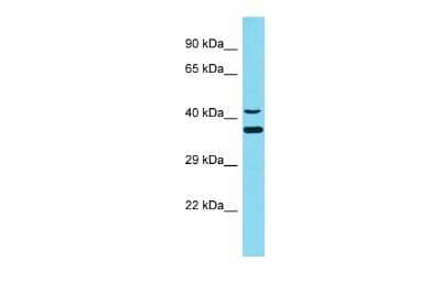 Western Blot: DNAJC18 Antibody [NBP2-84804] - Host: Rabbit. Target Name: DNAJC18. Sample Type: 293T Whole Cell lysates. Antibody Dilution: 1.0ug/ml