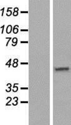 Western Blot: DNAJC18 Overexpression Lysate (Adult Normal) [NBP2-05323] Left-Empty vector transfected control cell lysate (HEK293 cell lysate); Right -Over-expression Lysate for DNAJC18.