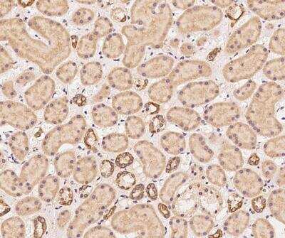 Immunohistochemistry-Paraffin: DNAJC2 Antibody [NBP3-12630] - Staining of human DNAJC2 in human kidney with rabbit polyclonal antibody at 1:100 dilution.