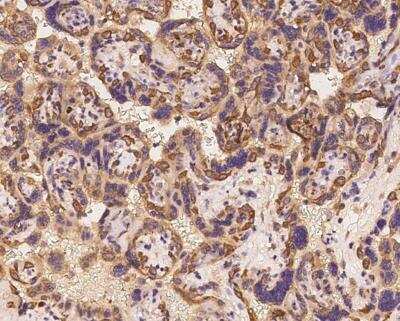 Immunohistochemistry-Paraffin: DNAJC2 Antibody [NBP3-12630] -  Staining of human DNAJC2 in human placenta with rabbit polyclonal antibody at 1:100 dilution.