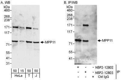 Immunoprecipitation: DNAJC2 Antibody [NBP2-12803] - Samples: Whole cell lysate from HeLa (15 and 50 ug for WB; 1 mg for IP, 20% of IP loaded), 293T (T; 50 ug) and Jurkat (J; 50 ug) cells. Antibodies: Affinity purified rabbit anti-DNAJC2 antibody A303-722A used for WB at 0.1 ug/ml (A) and 1 ug/ml (B) and used for IP at 6 ug/mg lysate. DNAJC2 was also immunoprecipitated by rabbit anti-DNAJC2 antibody NBP2-12802, which recognizes an upstream epitope. Detection: Chemiluminescence with exposure times of 30 seconds (A) and 10 seconds (B).