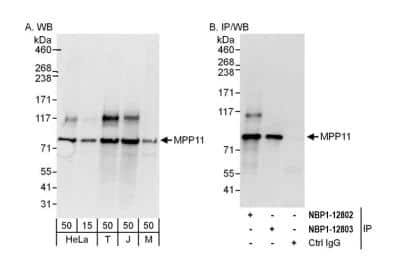 Western Blot: DNAJC2 Antibody [NBP2-12802] - Detection of human and mouse MPP11 by western blot (h and m) and immunoprecipitation (h). Samples: Whole cell lysate from HeLa (15 and 50 ug for WB; 1 mg for IP, 20% of IP loaded), HEK293T (T; 50 ug), Jurkat (J; 50 ug) and mouse NIH 3T3 (M; 50 ug) cells. Antibodies: Affinity purified rabbit anti-MPP11 antibody NBP2-12802 used for WB at 0.1 ug/ml (A) and 1 ug/ml (B) and used for IP at 6 ug/mg lysate. MPP11 was also immunoprecipitated by rabbit anti-MPP11 antibody NBP2-12803, which recognizes a downstream epitope. Detection: Chemiluminescence with exposure times of 10 seconds (A) and 3 seconds (B).