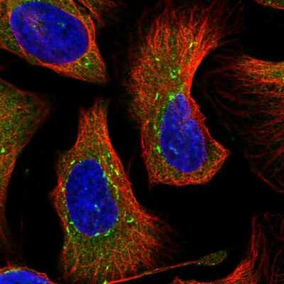 Immunocytochemistry/Immunofluorescence: DNAJC21 Antibody [NBP2-55467] - Staining of human cell line U-2 OS shows localization to cytosol & vesicles.