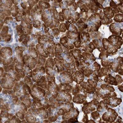 Immunohistochemistry-Paraffin: DNAJC21 Antibody [NBP1-85003] - Staining of human pancreas shows strong cytoplasmic and nucleolar positivity in exocrine glandular cells.