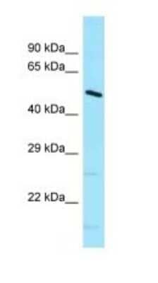 Western Blot: DNAJC21 Antibody [NBP1-98432] - Titration: 1.0 ug/ml Positive Control: Mouse Small Intestine.