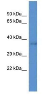 Western Blot: DNAJC22 Antibody [NBP1-79328] - Mouse Intestine Lysate 1ug/ml  Gel Concentration 12%