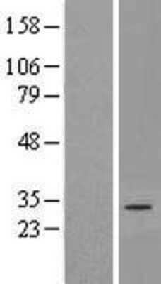 Western Blot: DNAJC22 Overexpression Lysate (Adult Normal) [NBP2-06271] Left-Empty vector transfected control cell lysate (HEK293 cell lysate); Right -Over-expression Lysate for DNAJC22.