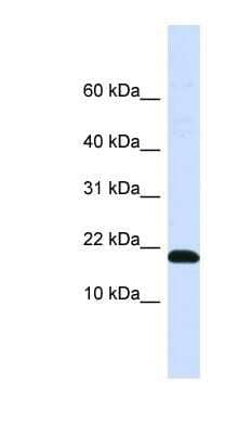 Western Blot: DNAJC25-GNG10 Antibody [NBP1-91558] - Titration: 0.2-1 ug/ml, Positive Control: Human Placenta.