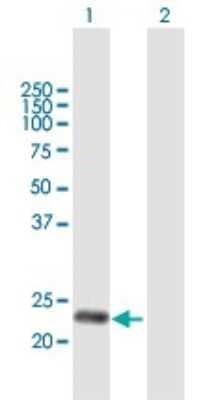 Western Blot DNAJC30 Antibody