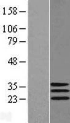 Western Blot: DNAJC30 Overexpression Lysate (Adult Normal) [NBL1-09953] Left-Empty vector transfected control cell lysate (HEK293 cell lysate); Right -Over-expression Lysate for DNAJC30.