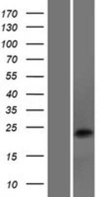 Western Blot DNAJC5B Overexpression Lysate