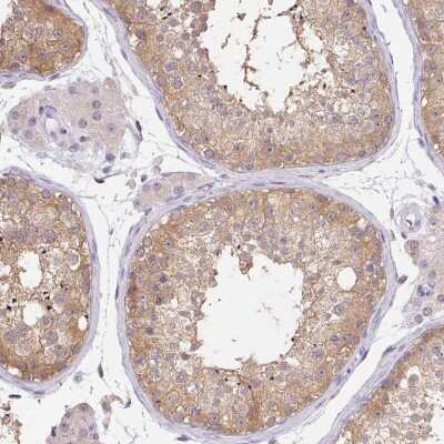 Immunohistochemistry: DNAJC5G Antibody [NBP2-38484] - Staining of human testis shows moderate cytoplasmic positivity in cells in seminiferous ducts.