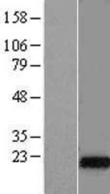 Western Blot: DNAJC5G Overexpression Lysate (Adult Normal) [NBL1-09955] Left-Empty vector transfected control cell lysate (HEK293 cell lysate); Right -Over-expression Lysate for DNAJC5G.