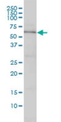 Western Blot DNAJC7 Antibody (4G6-G3) - Azide and BSA Free