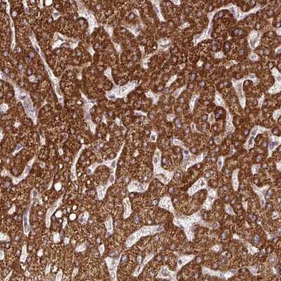 Immunohistochemistry: DNAJC7 Antibody [NBP2-38669] - Staining of human liver shows strong cytoplasmic positivity in hepatocytes.
