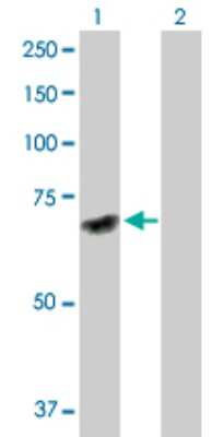 Western Blot: DNAJC7 Antibody [H00007266-D01P] - Analysis of DNAJC7 expression in transfected 293T cell line by DNAJC7 polyclonal antibody.Lane 1: DNAJC7 transfected lysate(55.50 KDa).Lane 2: Non-transfected lysate.