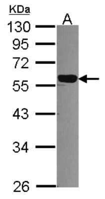 Western Blot: DNAJC7 Antibody [NBP2-16196] - Sample (30 ug of whole cell lysate) A: A431 10% SDS PAGE gel, diluted at 1:1000.