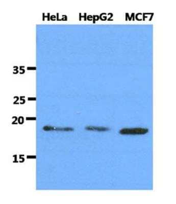 Western Blot: DNAL1 Antibody (29E4) [NBP2-42657] - The cell lysates of HeLa, HepG2 and MCF7 (40ug) were resolved by SDS-PAGE, transferred to PVDF membrane and probed with anti-human DNAL1 antibody (1:1000). Proteins were visualized using a goat anti-mouse secondary antibody conjugated to HRP and an ECL detection system