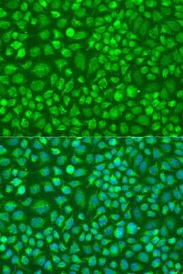 Immunocytochemistry/Immunofluorescence: DNAL1 Antibody [NBP2-92922] - Analysis of U2OS cells using DNAL1 at dilution of 1:100. Blue: DAPI for nuclear staining.
