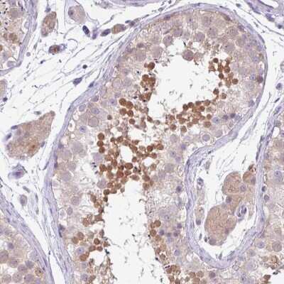 Immunohistochemistry-Paraffin: DNAL1 Antibody [NBP2-13929] - Staining of human testis shows moderate positivity in a subset of cells in seminiferous ducts.