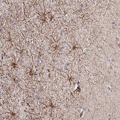 Immunohistochemistry-Paraffin: DNAL1 Antibody [NBP2-13929] - Staining of human cerebral cortex shows moderate positivity in astrocytes.