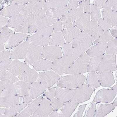 Immunohistochemistry-Paraffin: DNAL1 Antibody [NBP2-13929] - Staining of human skeletal muscle shows no positivity in myocytes as expected.