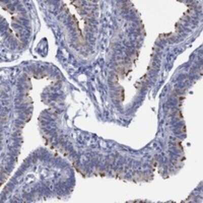 Immunohistochemistry-Paraffin: DNAL1 Antibody [NBP3-17701] - Staining of human fallopian tube shows strong ciliary positivity in glandular cells.