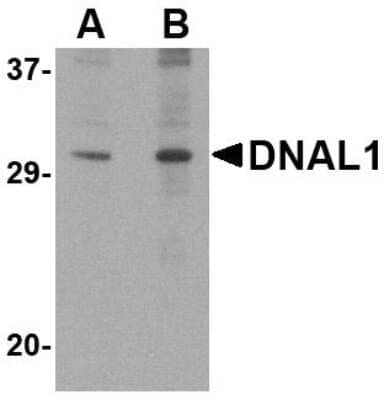 Western Blot: DNAL1 Antibody [NBP1-76932] - 3T3 cell lysate with DNAL1 antibody at (A) 1 and (B) 2 ug/ml.