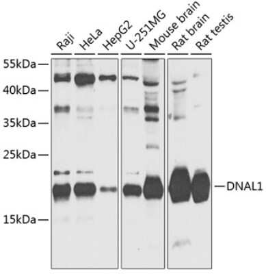 Western Blot: DNAL1 Antibody [NBP2-92704] - Analysis of extracts of various cell lines, using DNAL1 at 1:1000 dilution.Secondary antibody: HRP Goat Anti-Rabbit IgG (H+L) at 1:10000 dilution.Lysates/proteins: 25ug per lane.Blocking buffer: 3% nonfat dry milk in TBST.Detection: ECL Basic Kit .Exposure time: 30s.