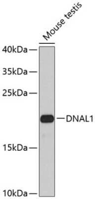 Western Blot: DNAL1 Antibody [NBP2-92922] - Analysis of extracts of mouse testis, using DNAL1 at 1:1000 dilution.Secondary antibody: HRP Goat Anti-Rabbit IgG (H+L) at 1:10000 dilution.Lysates/proteins: 25ug per lane.Blocking buffer: 3% nonfat dry milk in TBST.Detection: ECL Basic Kit .Exposure time: 90s.