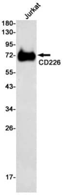 Western Blot: DNAM-1/CD226 Antibody (S03-4I5) [NBP3-20033] - Western blot detection of DNAM-1/CD226 in Jurkat cell lysates using NBP3-20033 (1:500 diluted). Predicted band size: 39kDa. Observed band size: 60-80kDa.